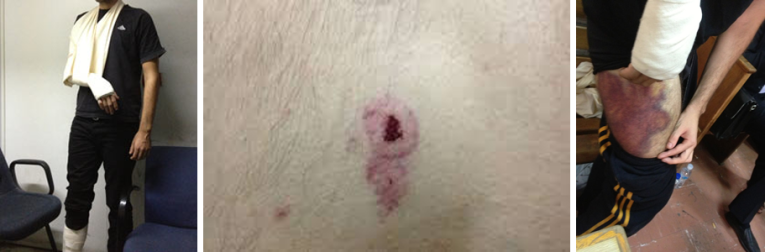 Antifascist protesters tortured by Greek police